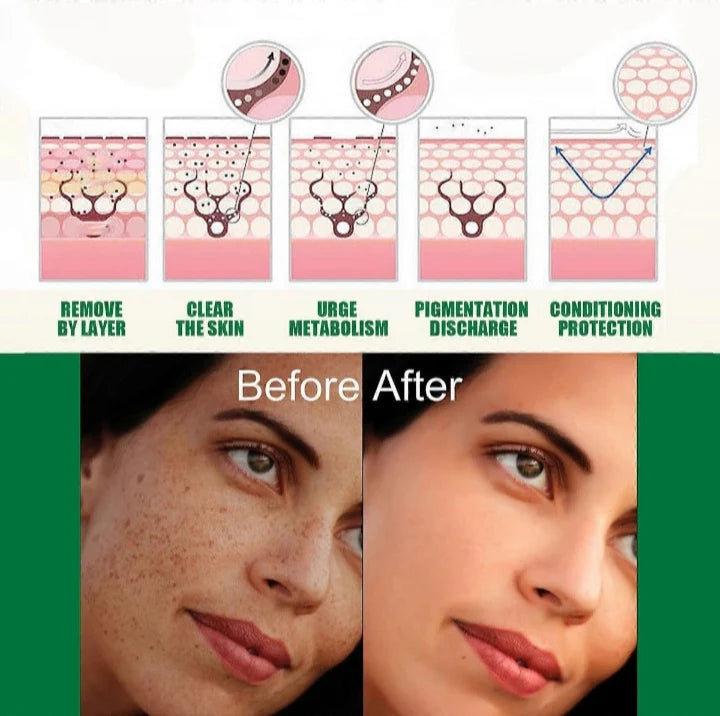 Correcting Glow Serum & Hoygi Niacinamide 10%+TXA 3% Serum